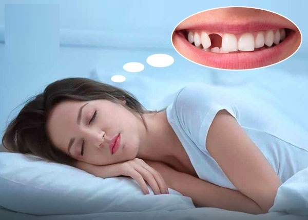 Read more about the article Giải mã mơ thấy răng – Điềm lành hay điềm xấu?